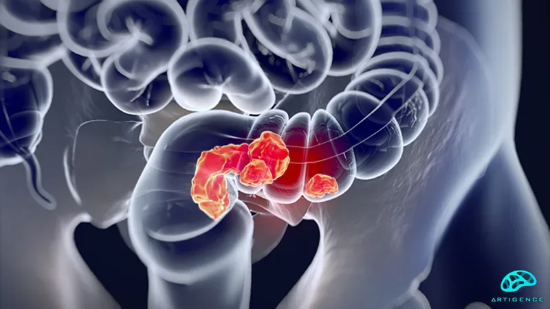 AI-colonoscopy-tool