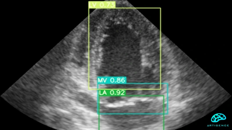 AI-in-ultrasound