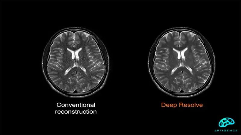 deep-learning-in-MRI